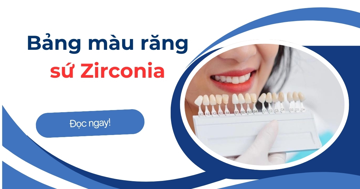 Bảng màu răng sứ Zirconia có mấy loại? Nên chọn loại nào?