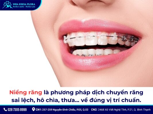 niềng răng - ảnh 1 niềng răng - ảnh 1