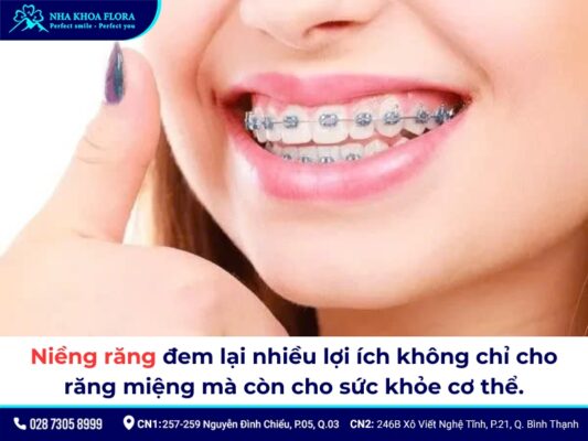 niềng răng - ảnh 3 niềng răng - ảnh 3