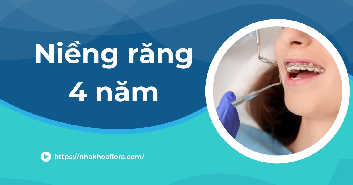Niềng răng 4 năm là gì? Cách rút ngắn thời gian chỉnh nha
