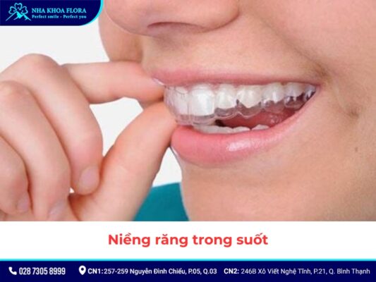 niềng răng - ảnh 7 niềng răng - ảnh 7
