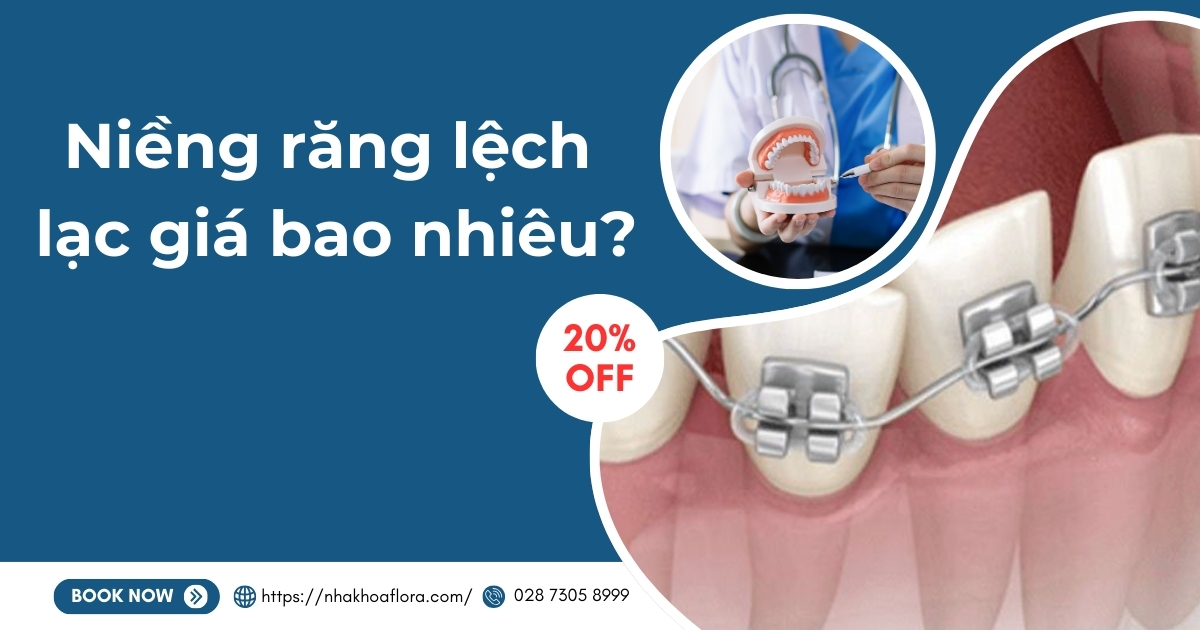 Niềng răng lệch lạc giá bao nhiêu? Bảng giá chỉnh răng lệch
