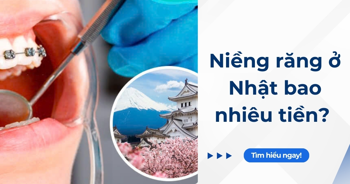 Niềng răng ở Nhật bao nhiêu tiền? So sánh giá với Việt Nam