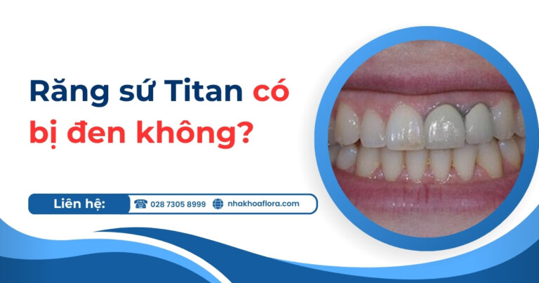 răng sứ Titan có bị đen không