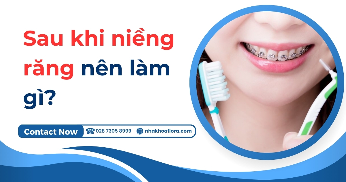 Sau khi niềng răng nên làm gì? Nên ăn gì? Vệ sinh ra sao?