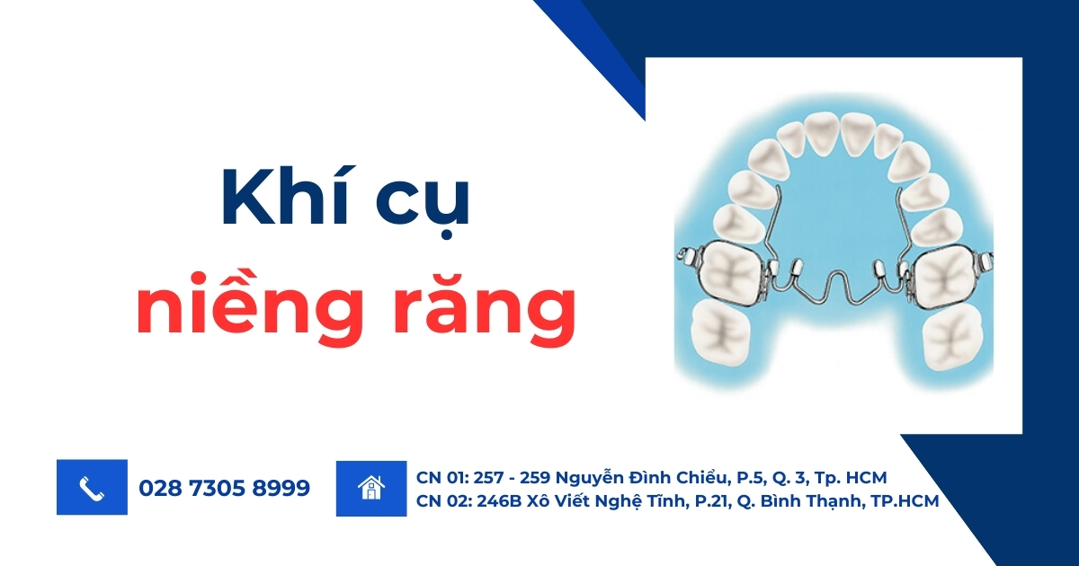 Khí cụ niềng răng là gì? Các loại khí cụ chỉnh nha phổ biến