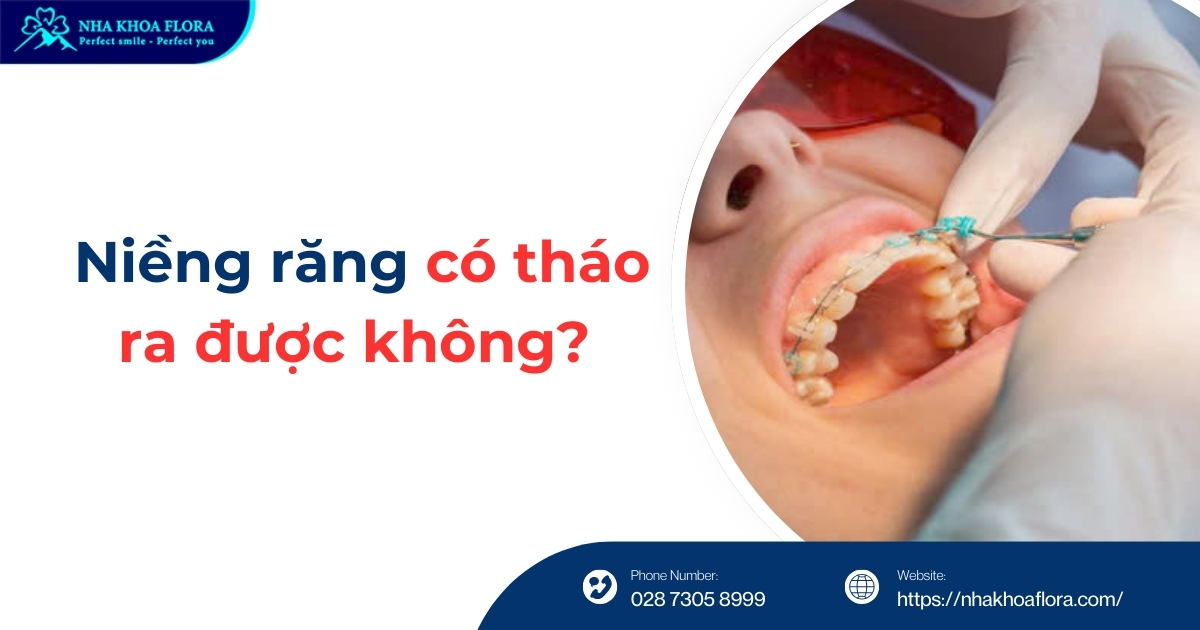 Niềng răng có tháo ra được không? Có ảnh hưởng gì không?
