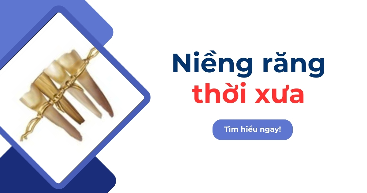 Niềng răng thời xưa: Lịch sử hình thành và sự phát triển