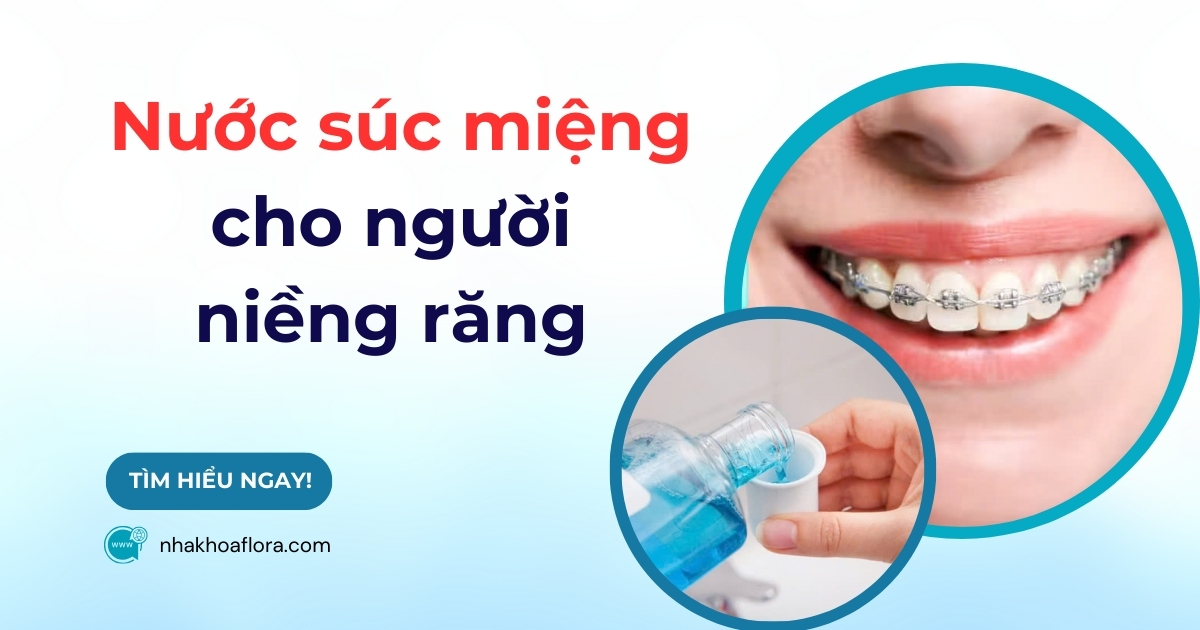 Top 6 nước súc miệng cho người niềng răng tốt nhất 2025