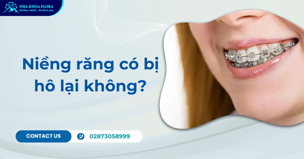 Niềng răng có bị hô lại không? Nguyên nhân & phòng tránh