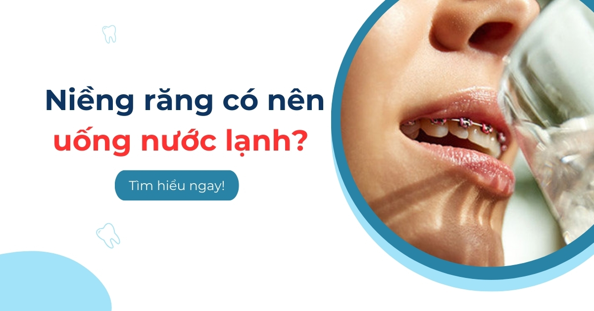 Niềng răng có nên uống nước lạnh? Có ảnh hưởng gì không?