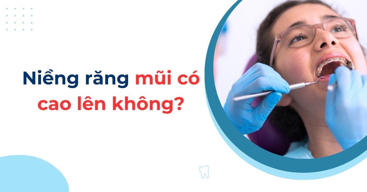 Niềng răng mũi có cao lên không? Có thay đổi góc nghiêng?