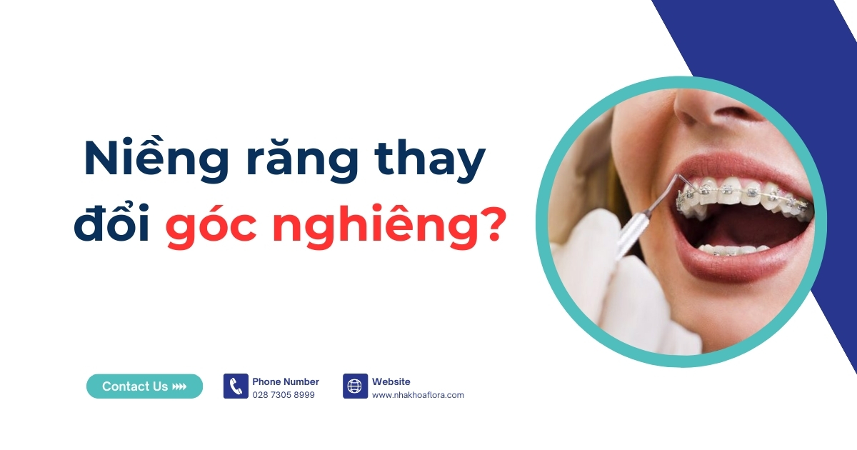 Niềng răng thay đổi góc nghiêng thật không? Thay đổi ra sao?