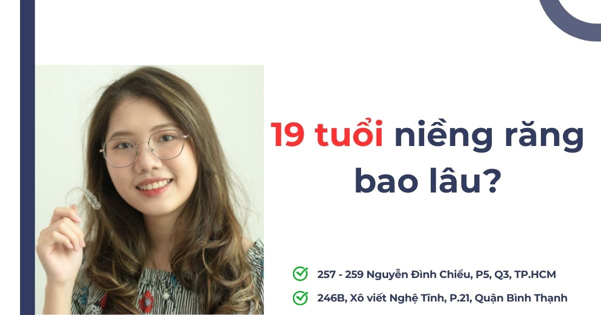 19 tuổi niềng răng bao lâu? Chi phí hết bao nhiêu tiền?