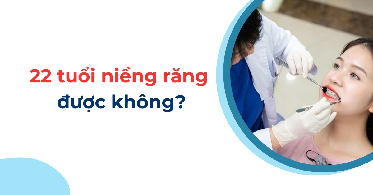 22 tuổi niềng răng được không? Có đem lại hiệu quả không?