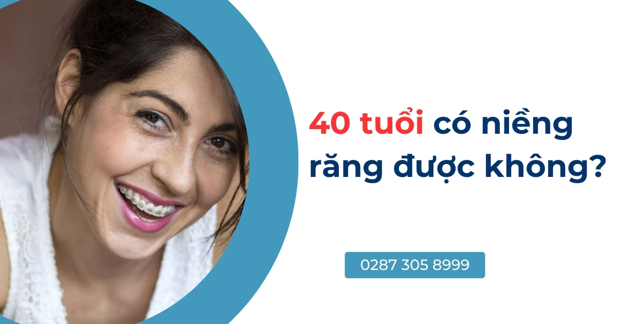 40 tuổi có niềng răng được không? Mất bao lâu thời gian?
