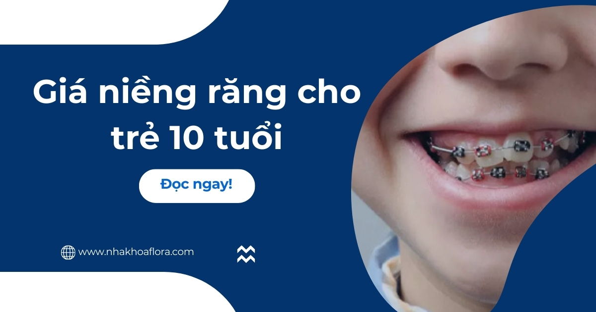 Giá niềng răng cho trẻ 10 tuổi bao nhiêu tiền mới nhất?