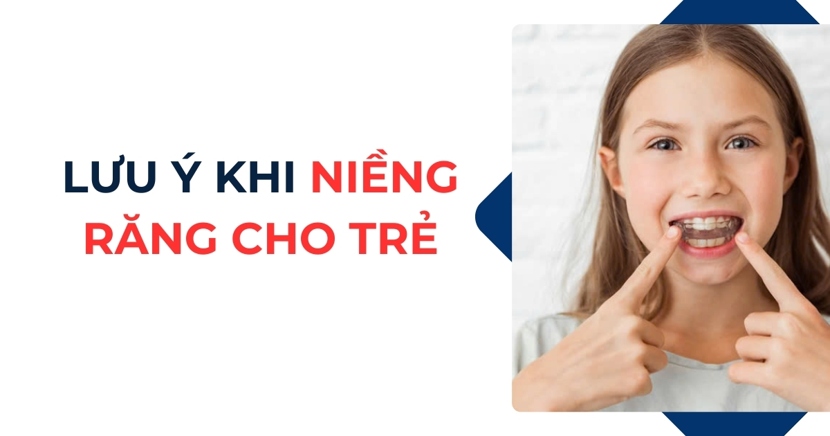 Bỏ túi 7 lưu ý khi niềng răng cho trẻ phụ huynh nên biết