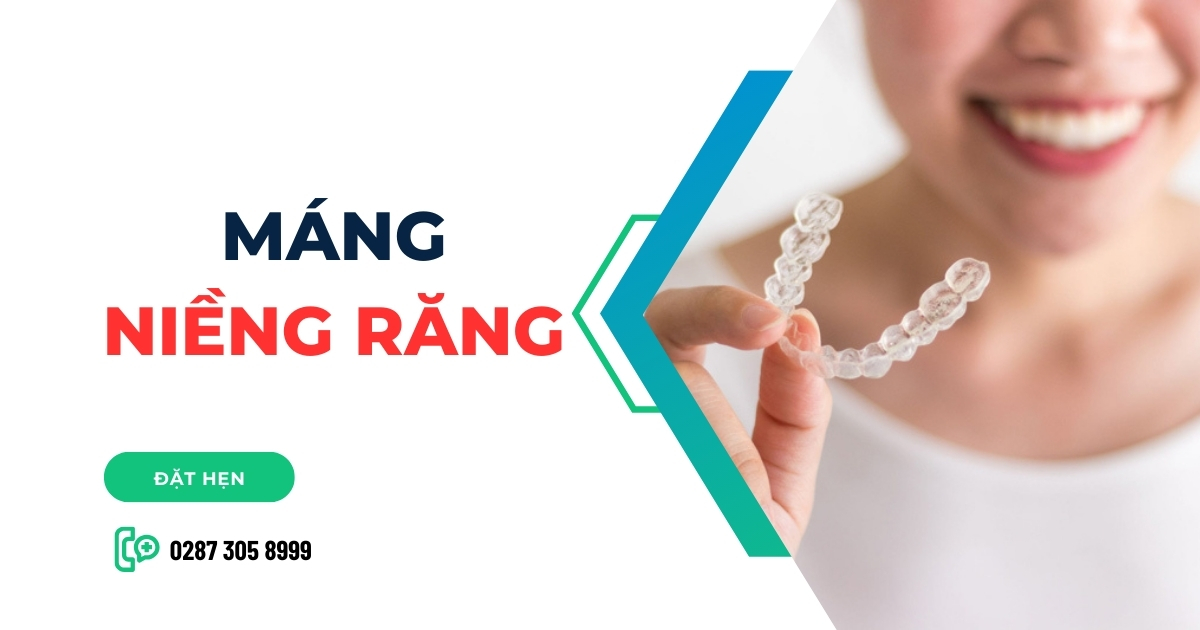 Máng niềng răng là gì? Có mấy loại? Giá bao nhiêu tiền?