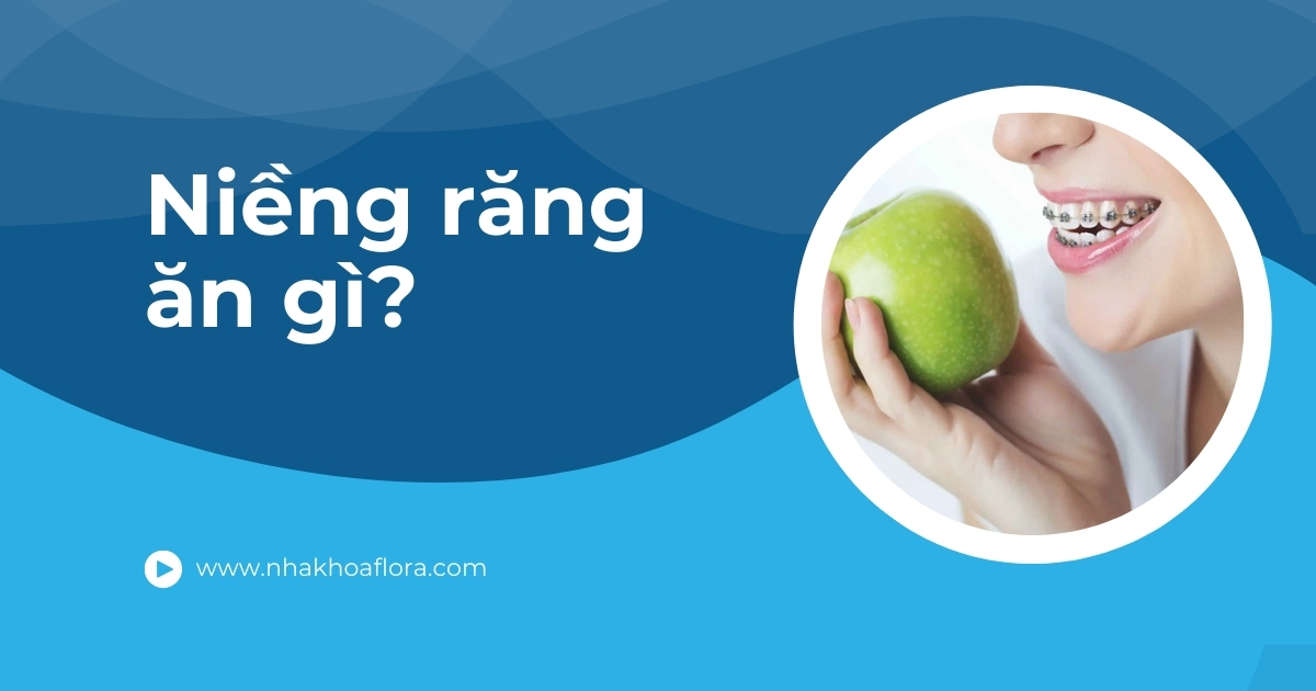 Niềng răng ăn gì để không đau và đảm bảo điều trị hiệu quả?