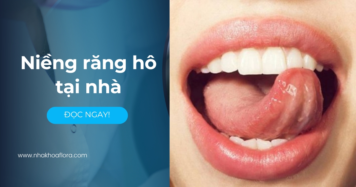 Niềng răng hô tại nhà bằng cách nào? Có nên áp dụng không?