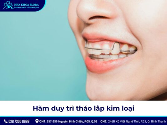 Hàm duy trì sau niềng răng giá bao nhiêu? - ảnh 3 Hàm duy trì sau niềng răng giá bao nhiêu? - ảnh 3