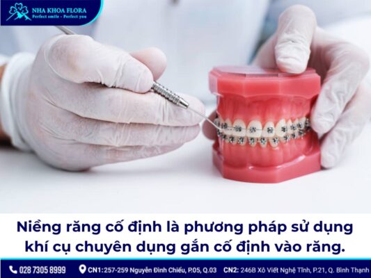 niềng răng cố định - ảnh 1 niềng răng cố định - ảnh 1