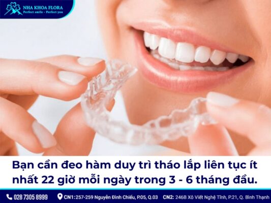 niềng răng đeo hàm duy trì bao lâu - ảnh 2 niềng răng đeo hàm duy trì bao lâu - ảnh 2