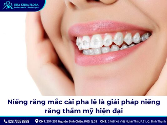 niềng răng mắc cài pha lê - ảnh 1 niềng răng mắc cài pha lê - ảnh 1