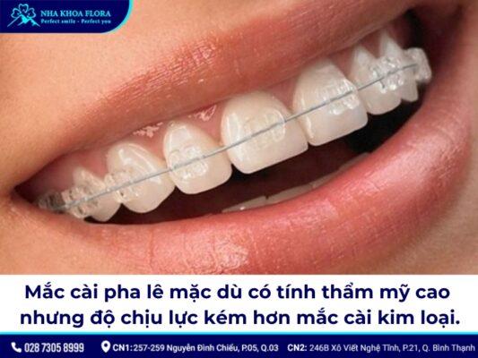 niềng răng mắc cài pha lê - ảnh 2 niềng răng mắc cài pha lê - ảnh 2