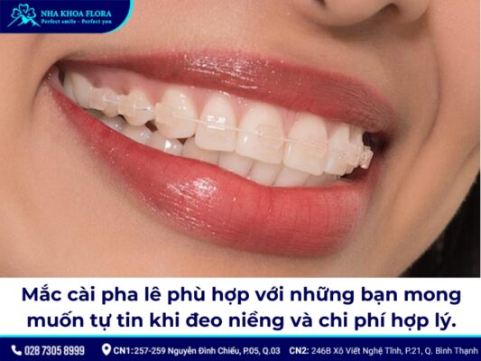 niềng răng mắc cài pha lê - ảnh 3 niềng răng mắc cài pha lê - ảnh 3
