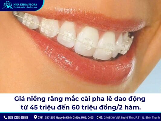 niềng răng mắc cài pha lê - ảnh 4 niềng răng mắc cài pha lê - ảnh 4
