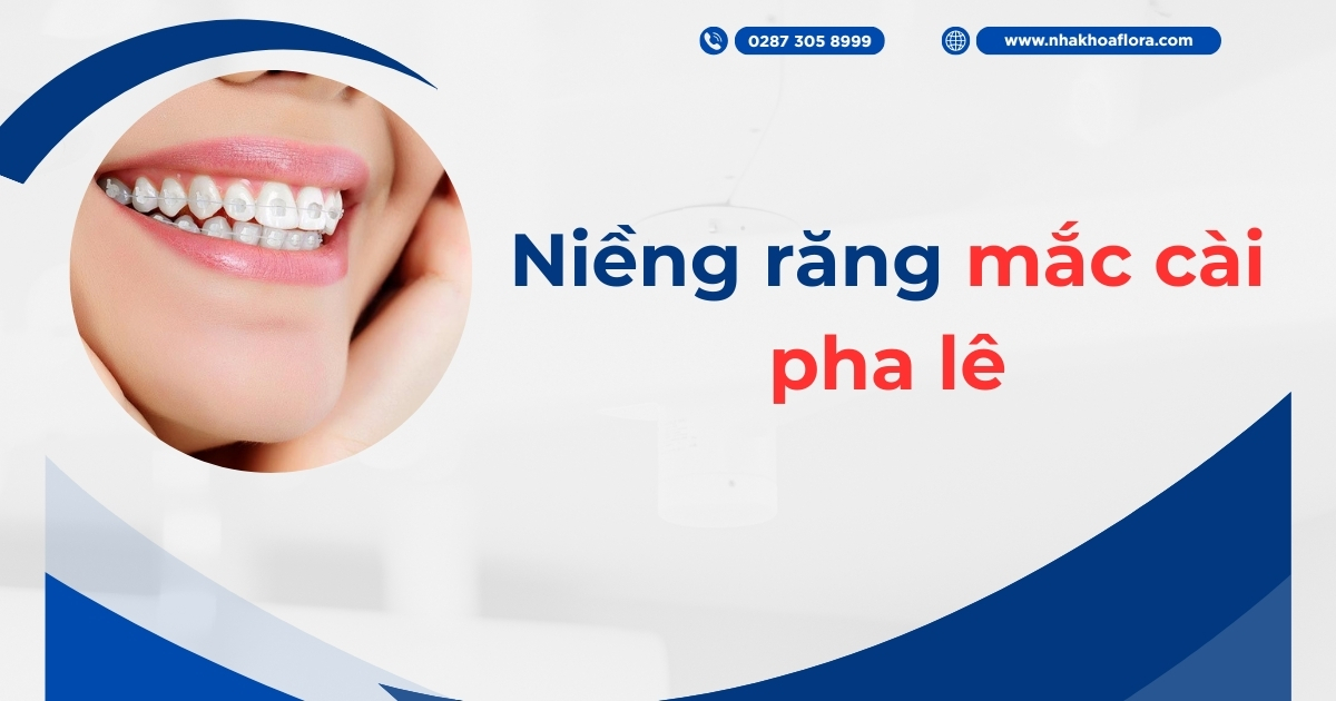 Niềng răng mắc cài pha lê có tốt không? Giá bao nhiêu tiền?
