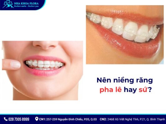 niềng răng pha lê và sứ - ảnh 3 niềng răng pha lê và sứ - ảnh 3
