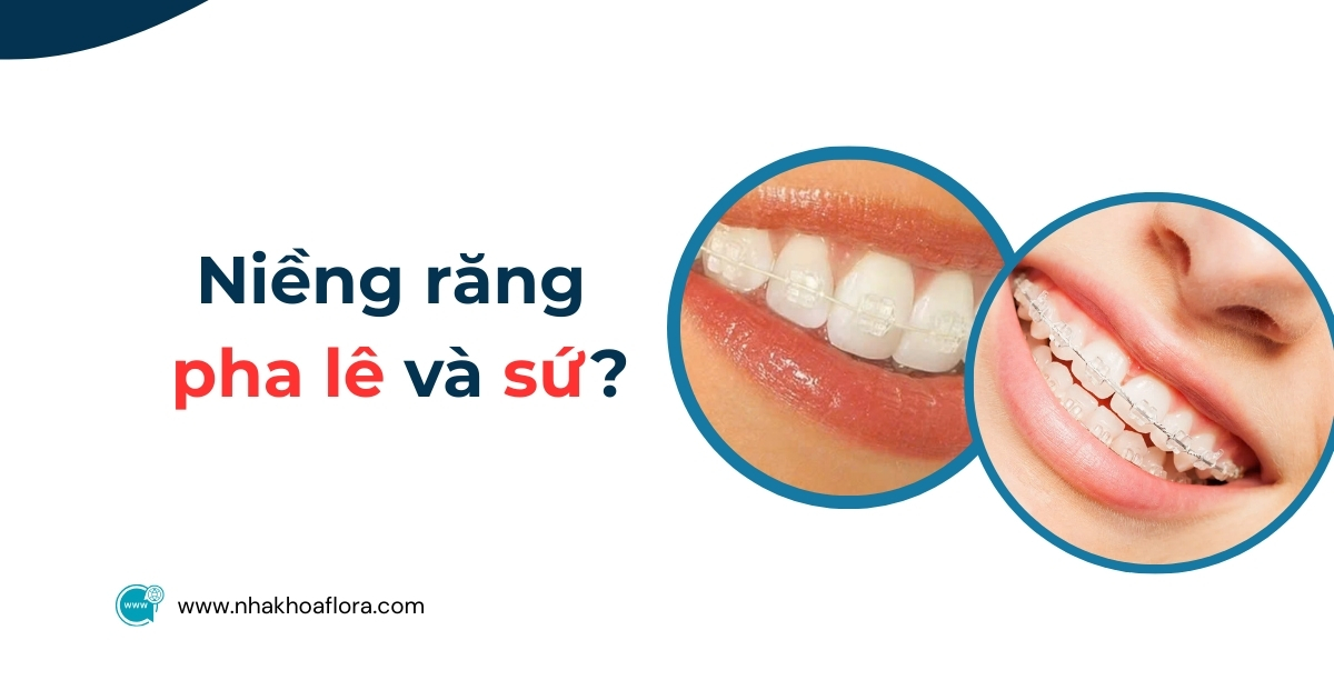 Niềng răng pha lê và sứ có gì khác biệt? Nên chọn loại nào?