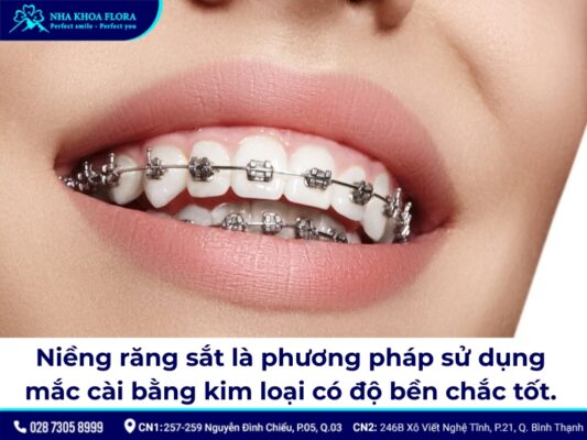 niềng răng sắt - ảnh 1 niềng răng sắt - ảnh 1