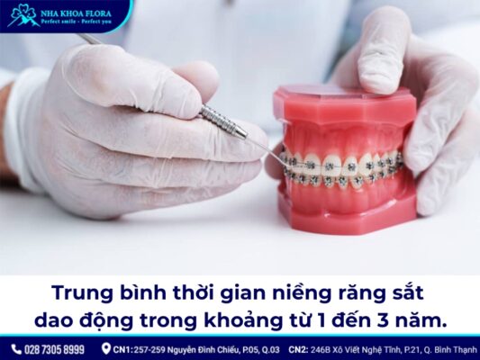 niềng răng sắt - ảnh 3 niềng răng sắt - ảnh 3