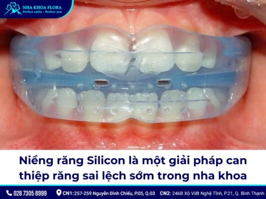 niềng răng silicon - ảnh 1 niềng răng silicon - ảnh 1