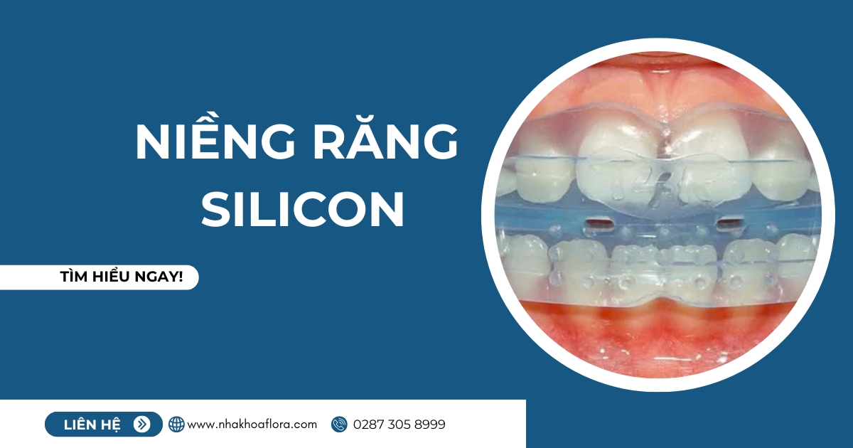 Niềng răng Silicon là gì? Có hiệu quả không? Giá bao nhiêu?
