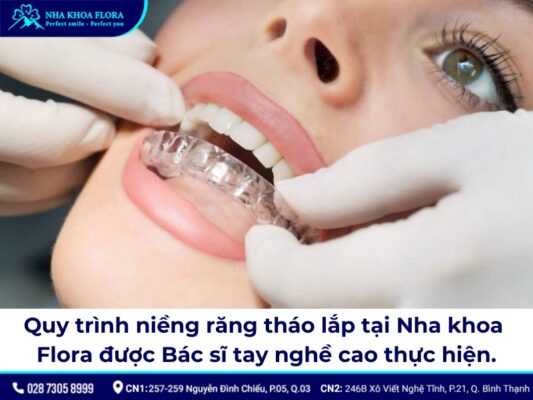 niềng răng tháo lắp - ảnh 10 niềng răng tháo lắp - ảnh 10