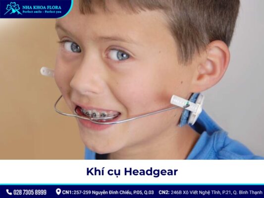 niềng răng tháo lắp - ảnh 4 niềng răng tháo lắp - ảnh 4