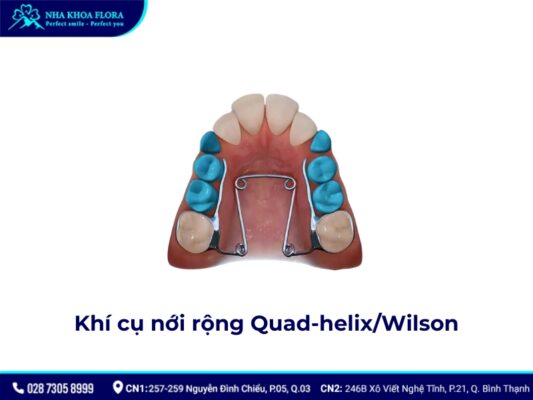 niềng răng tháo lắp - ảnh 5 niềng răng tháo lắp - ảnh 5