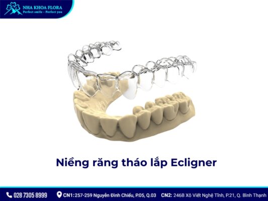 niềng răng tháo lắp - ảnh 7 niềng răng tháo lắp - ảnh 7