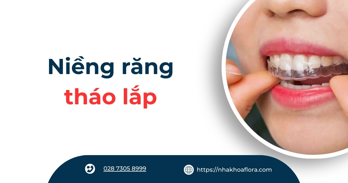 Niềng răng tháo lắp có hiệu quả không? Giá bao nhiêu tiền?
