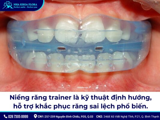 niềng răng trainer - ảnh 1 niềng răng trainer - ảnh 1
