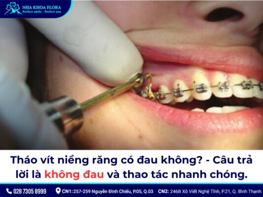 tháo vít niềng răng - ảnh 1 tháo vít niềng răng - ảnh 1