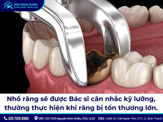 Nhổ răng không trồng lại có sao không? - ảnh 1 Nhổ răng không trồng lại có sao không? - ảnh 1