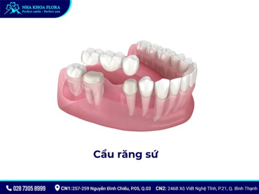 Nhổ răng không trồng lại có sao không? - ảnh 5 Nhổ răng không trồng lại có sao không? - ảnh 5