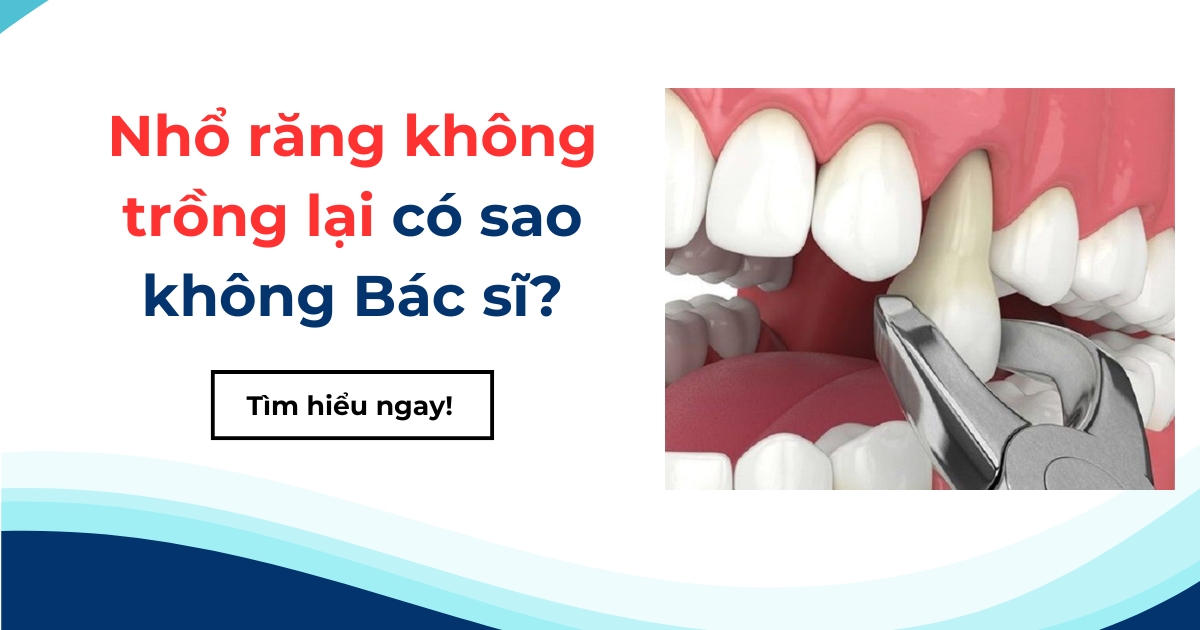 [Hỏi đáp]: Nhổ răng không trồng lại có sao không Bác sĩ?