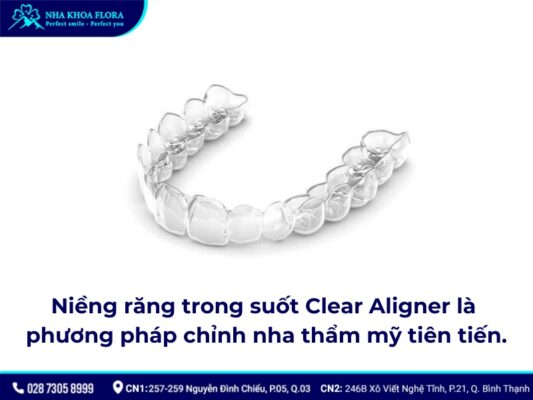 Niềng răng trong suốt Clear Aligner - ảnh 1 Niềng răng trong suốt Clear Aligner - ảnh 1